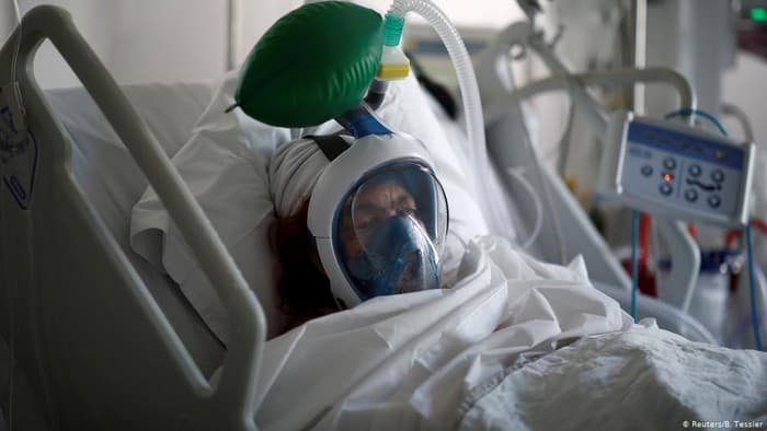 Beredar Pesan Bahaya Ventilator bagi Pasien Corona, Ini Kata Kadinkes